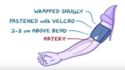 Video: Preparing an individual for blood pressure measurement